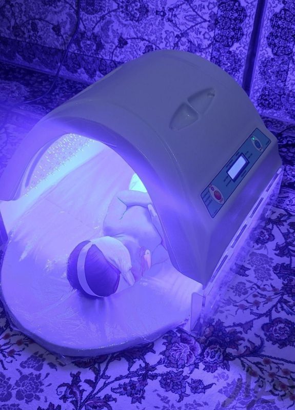 اجاره دستگاه زردی نوزاد در تهران 4 اجاره دستگاه زردی نوزاد در غرب تهران