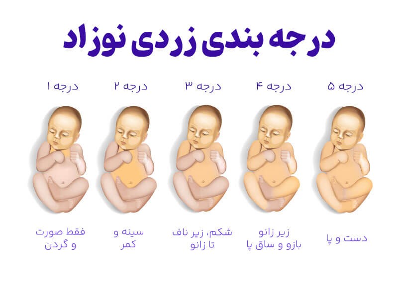بهترین دکتر متخصص زردی نوزاد 2 متخصص زردی نوزاد