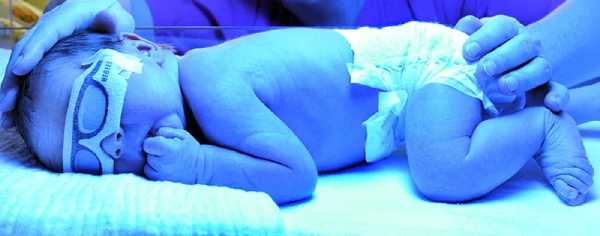 دستگاه زردی نوزاد چگونه کار میکند؟