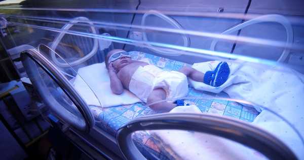 چکار کنیم زردی نوزاد از بین بره